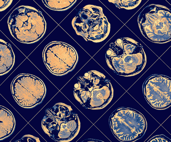 illustration of brain imaging arranged in diagonal rows