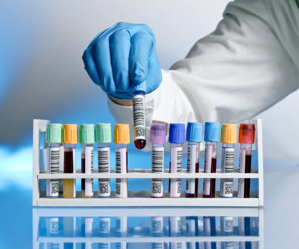 A medical professional wearing blue gloves positions a tube of blood in a row with other tubes.
