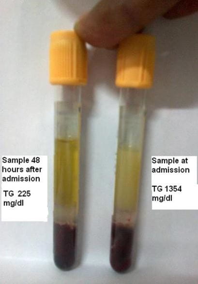 Is such extreme hyperphosphatemia possible clinically?