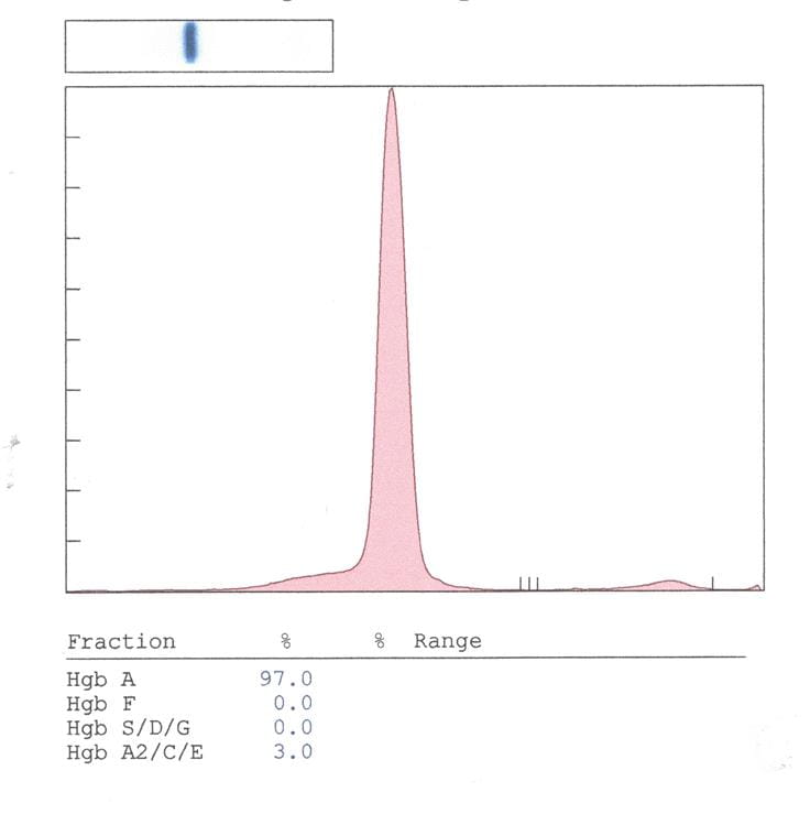 Where Is the Hemoglobin S?