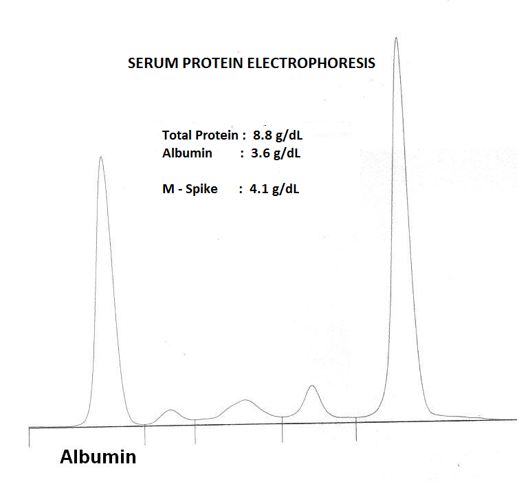 A preanalytical problem or something more?