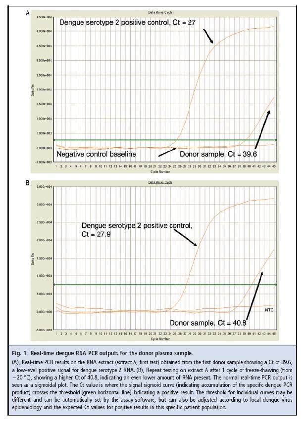 Fig 1 Real-time dengue RNA PCR outputs for the donor plasma sample