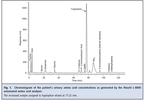 Fig 1. Chromatogram of the patient's urinary amino acid concentrations as genearted by Hitachi L-8800
