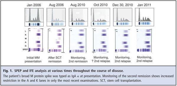Fig 1. SPEP and IFE analysis at various times through the course of the disease