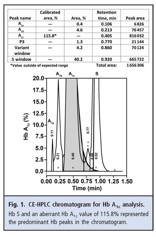 CE-HPLC chromatogram for Hb A1c analysis