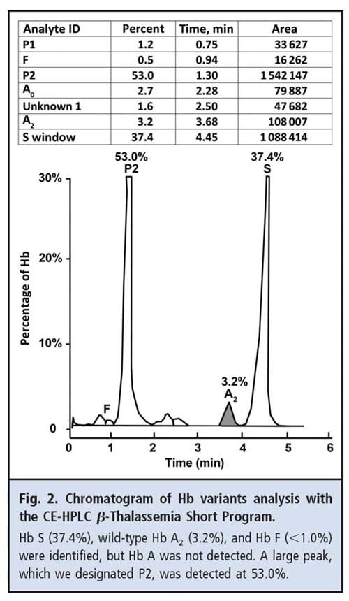 Fig 2 Chromatogram of Hb variants analysis with the CE-HPLC beta-thalassemia short program