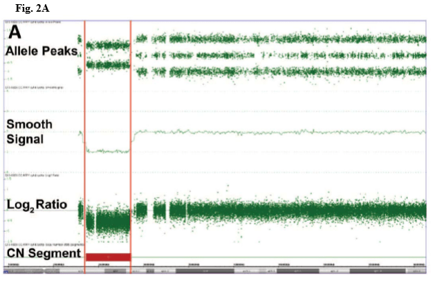 Figure 2A
