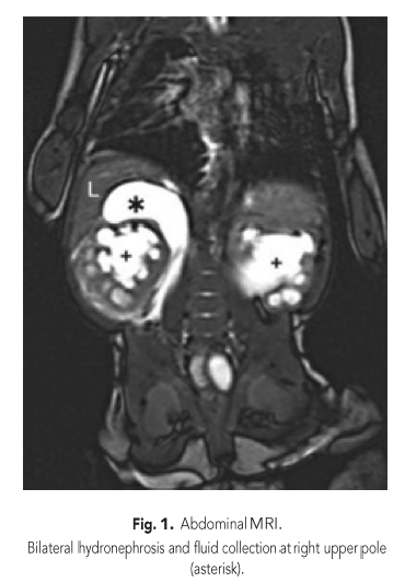 Figure 1 Abdominal MRI