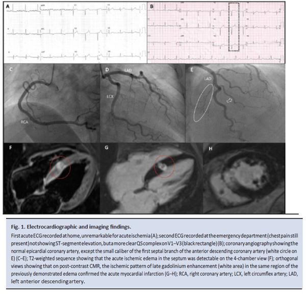 Figure 1 Electrocardiographic and imaging findings