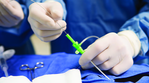 percutaneous coronary intervention pharmacogenomics