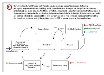 Figure 1 sickle cell