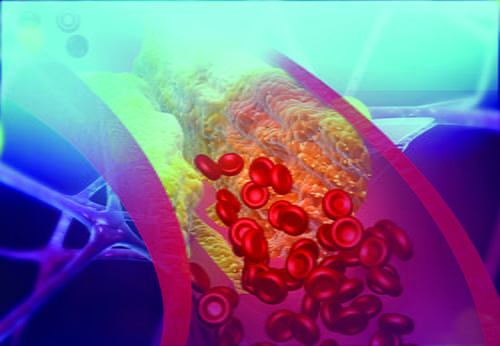 An image of lipid cells within human body.