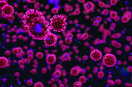 Pink virus molecules floating in front of a black background.