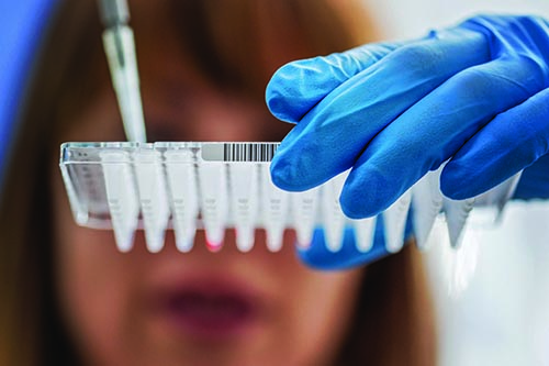 A woman laboratorian holding using a dropper on a sample rack.