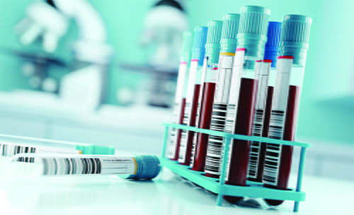 A tray of blood samples in test tubes.