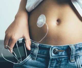 Glucose monitoring technology shows promise but practical challenges still need to be worked out.