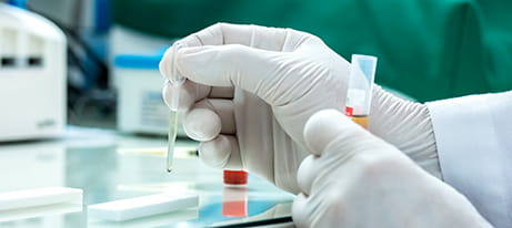 Two gloved hands hold in one hand a pipette tip dripping solution onto a test strip and in the other a sample tube containing solution