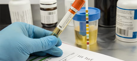 A gloved hand holds an orange-topped test tube; in the background is a urine sample.