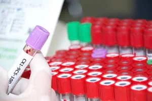 Lab vials