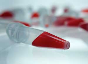 Close up of blood in a vial
