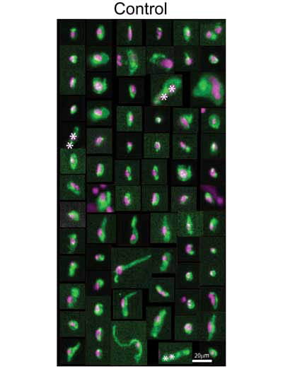 Circulating endothelial cells from heart attack patients