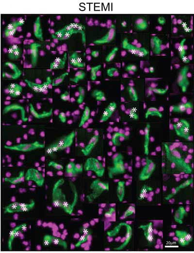 Healthy circulating endothelial cells