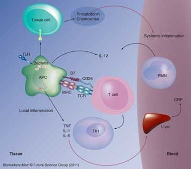 Figure 1: Pro-inflammatory Phase of Sepsis