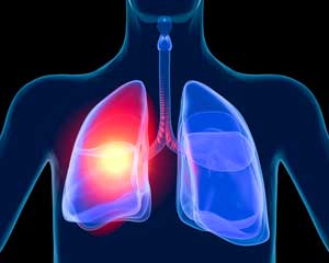 Illuminated lung
