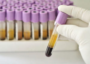 Vial of Vitamin D