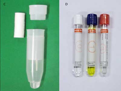 Salivette cotton and synthetic device and Greiner Bio-One saliva collection system