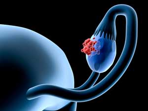 ovary