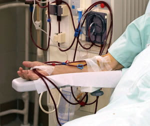 dialysis