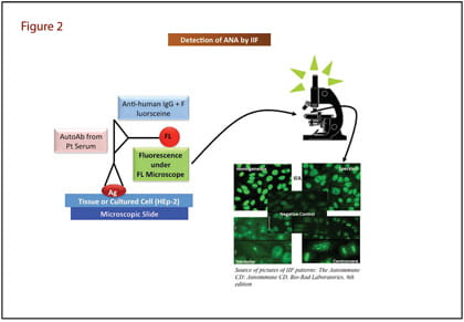 Detection of ANA by IIF