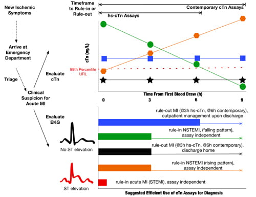 Suggested Efficient Use of cTn Assays for Diagnosis