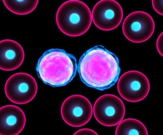 Leukemia