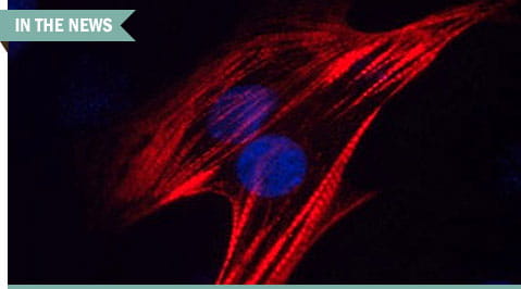 troponinincardiacdisease