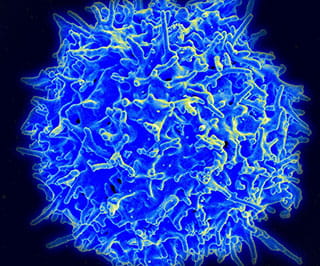 Immunotherapy in Diabetes