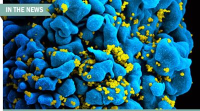 HIV virus
