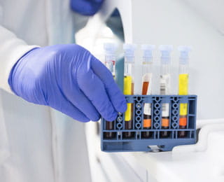 Liquid biopsy