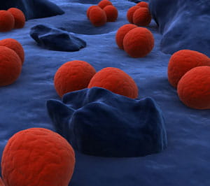 STD image
