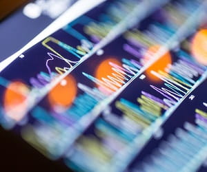 DNA Sequence
