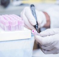 USB blood sample